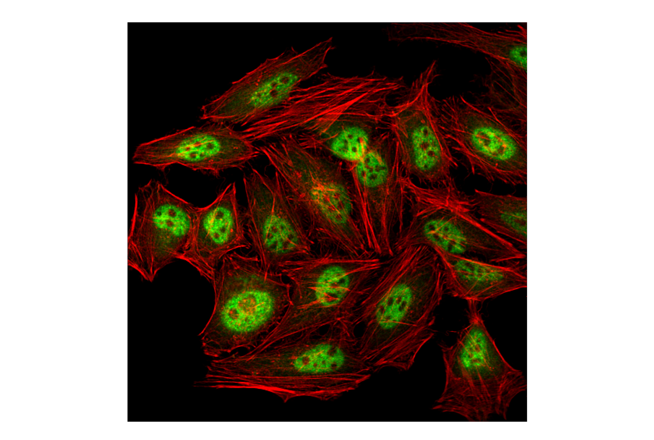 Immunofluorescence Image 1: PRMT4/CARM1 (3H2) Mouse mAb
