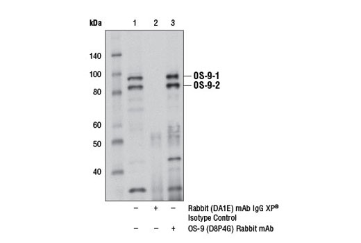 Immunoprecipitation Image 1: OS-9 (D8P4G) Rabbit mAb