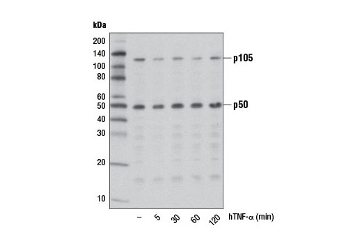  Image 18: NF-κB Family Member Antibody Sampler Kit