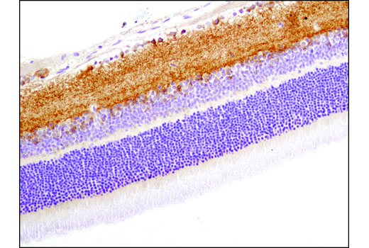  Image 17: Fragile X/FMRP Signaling Pathway Antibody Sampler Kit