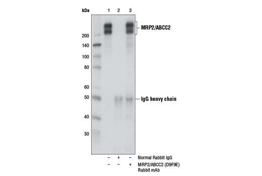 Immunoprecipitation Image 1: MRP2/ABCC2 (D9F9E) Rabbit mAb