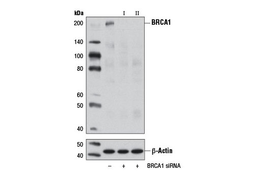  Image 1: SignalSilence® BRCA1 siRNA II