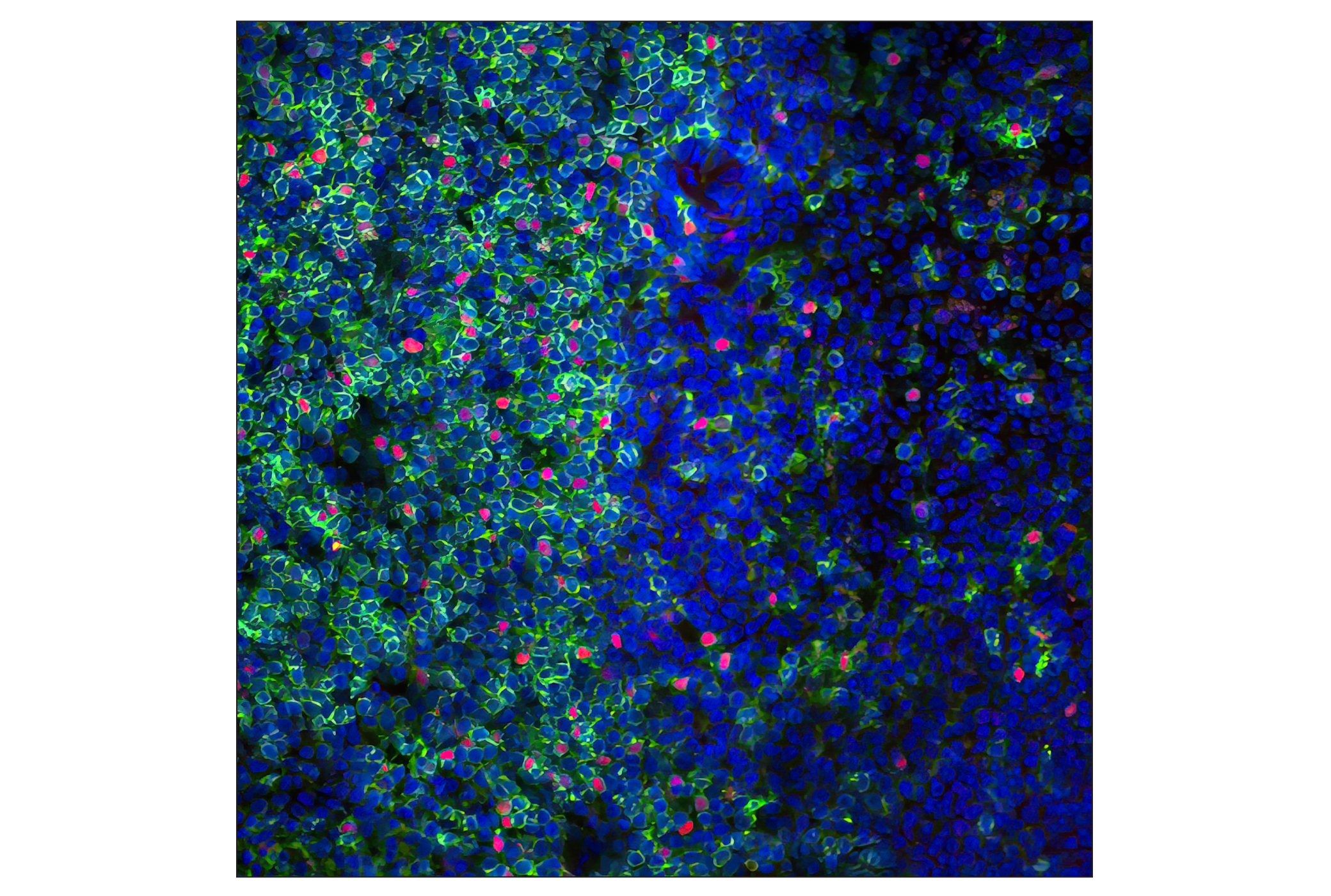 Immunofluorescence Image 1: FoxP3 (D6O8R) Rabbit mAb