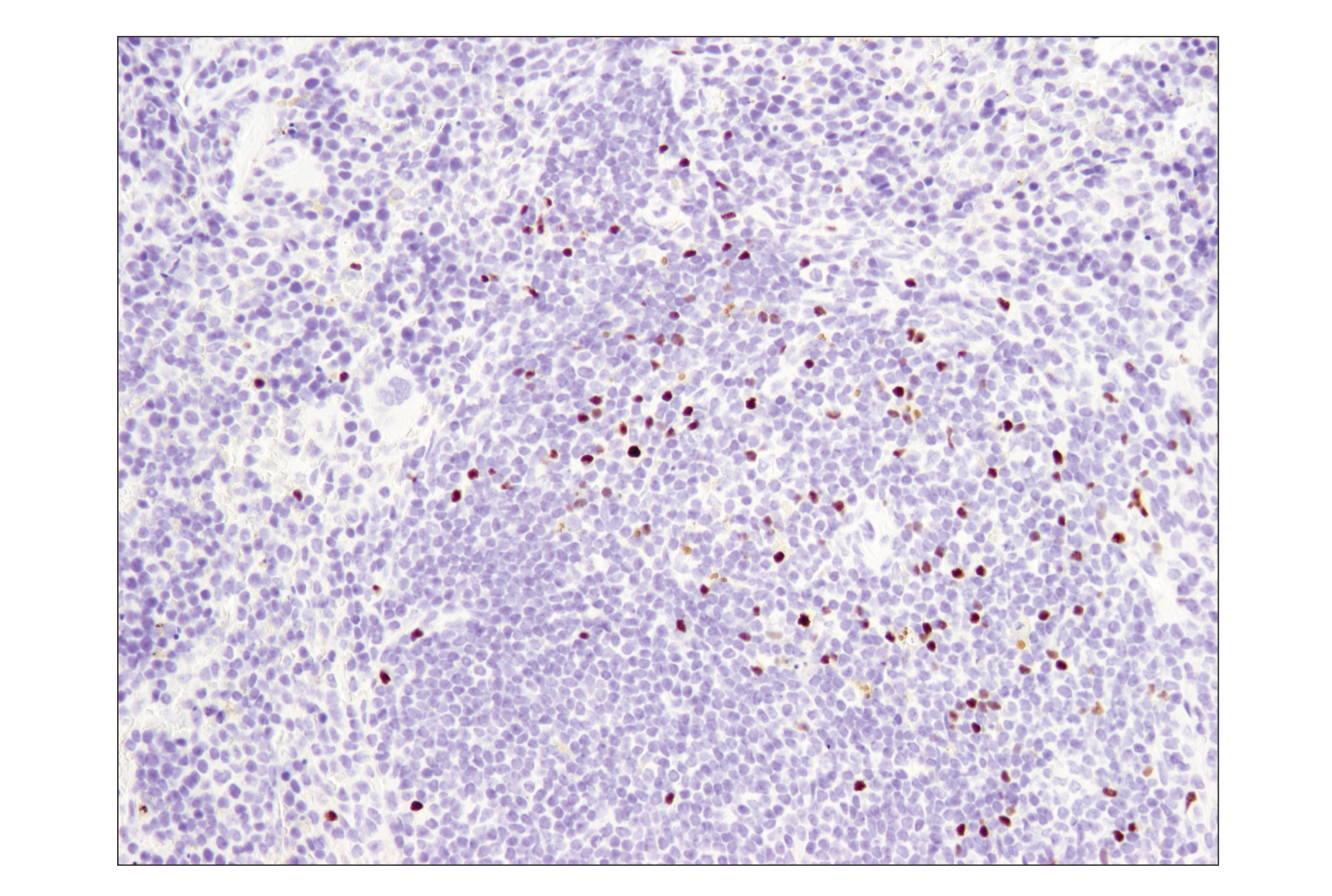 Immunohistochemistry Image 3: FoxP3 (D6O8R) Rabbit mAb