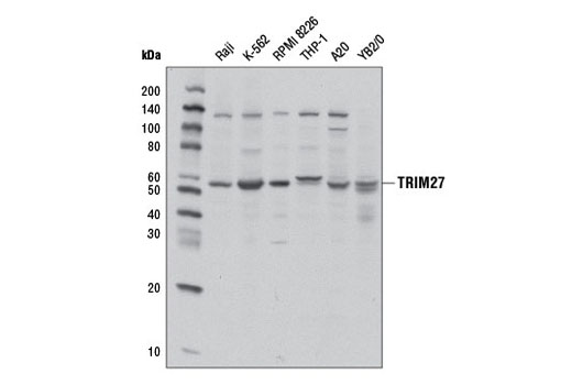 Western Blotting Image 1: TRIM27 Antibody