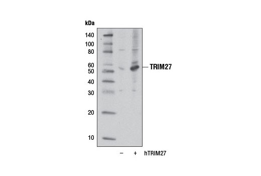 Western Blotting Image 2: TRIM27 Antibody