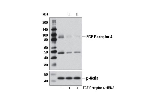  Image 1: SignalSilence® FGF Receptor 4 siRNA II