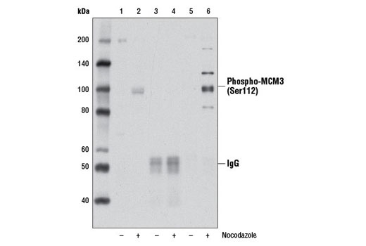 Immunoprecipitation Image 1: Phospho-MCM3 (Ser112) (D3S4M) Rabbit mAb