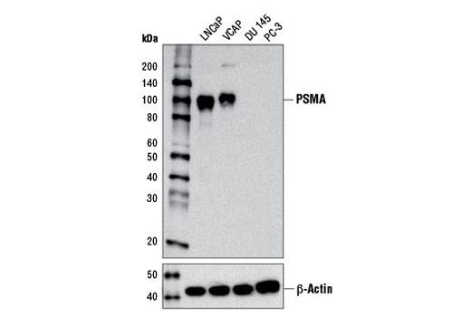Western Blotting Image 1: Prostate Specific Membrane Antigen (D4S1F) Rabbit mAb