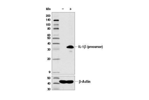  Image 5: Human Reactive Inflammasome Antibody Sampler Kit II