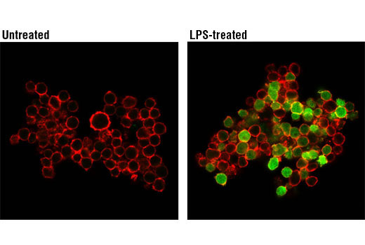 Immunofluorescence Image 1: IL-1β (D3U3E) Rabbit mAb