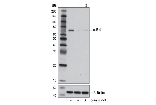  Image 18: NF-κB Family Antibody Sampler Kit II
