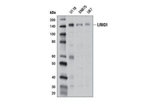 Western Blotting Image 1: LRIG1 Antibody