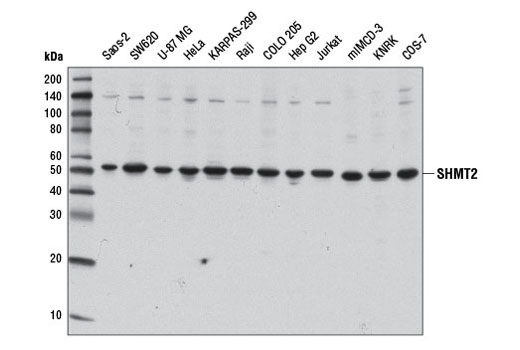 Western Blotting Image 1: SHMT2 Antibody