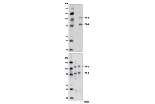  Image 2: Progesterone Receptor Signaling Antibody Sampler Kit