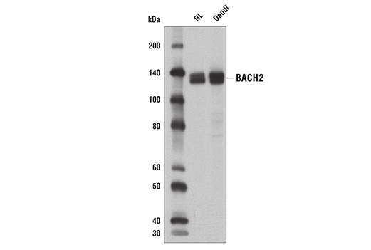 Western Blotting Image 1: BACH2 Antibody