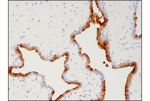 Immunohistochemistry Image 1: Prostate Specific Membrane Antigen (D7I8E) XP® Rabbit mAb