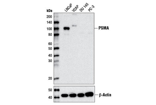Western Blotting Image 1: Prostate Specific Membrane Antigen (D7I8E) XP® Rabbit mAb
