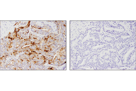 Immunohistochemistry Image 3: Prostate Specific Membrane Antigen (D7I8E) XP® Rabbit mAb