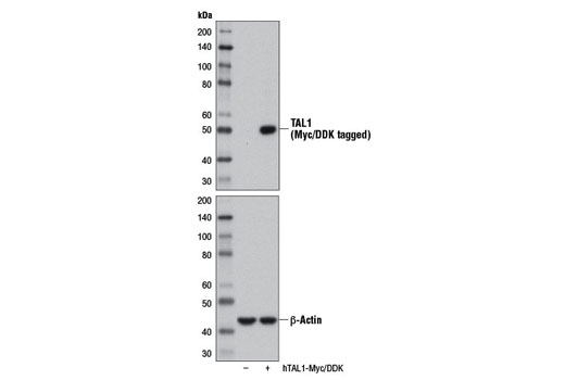 Western Blotting Image 1: TAL1 Antibody