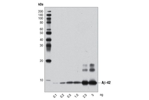  Image 9: β-Amyloid Peptides Antibody Sampler Kit