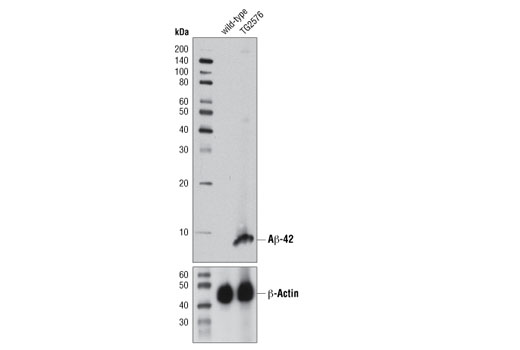  Image 13: β-Amyloid Peptides Antibody Sampler Kit