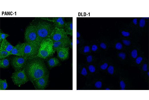 Immunofluorescence Image 1: β2-microglobulin (D8P1H) Rabbit mAb