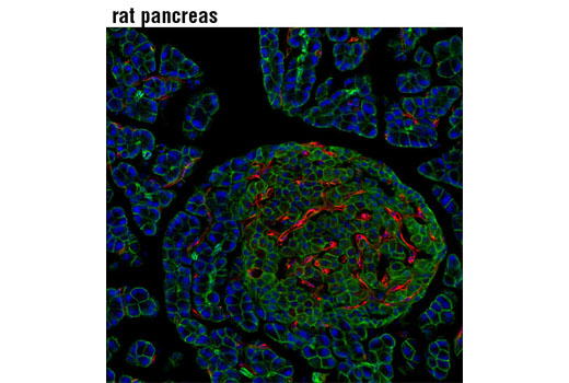 Immunofluorescence Image 1: VEGF Receptor 2 (D5B1) Rabbit mAb (Alexa Fluor® 555 Conjugate)