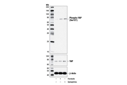  Image 10: PhosphoPlus® YAP (Ser127) Antibody Duet