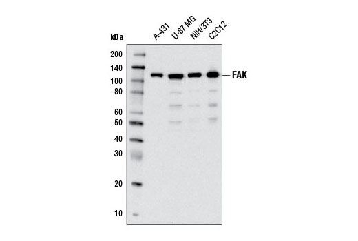  Image 3: FAK Antibody Sampler Kit