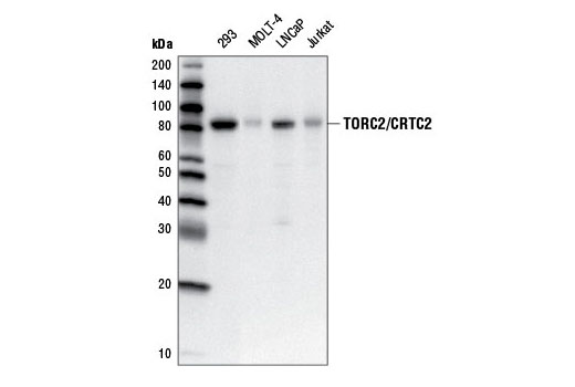 Western Blotting Image 1: TORC2/CRTC2 (5B10) Mouse mAb