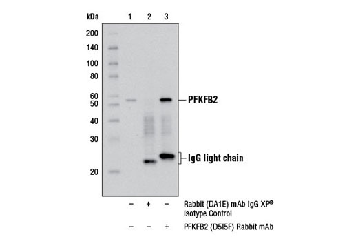 Immunoprecipitation Image 1: PFKFB2 (D5I5F) Rabbit mAb