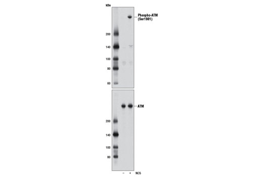  Image 2: PhosphoPlus® ATM (Ser1981) Antibody Duet