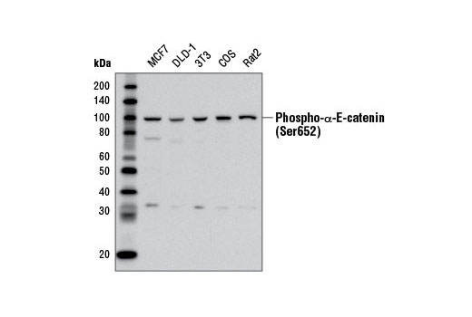Western Blotting Image 1: Phospho-α-E-Catenin (Ser652) Antibody
