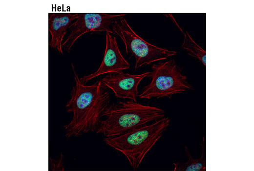 Immunofluorescence Image 1: Ring1A (D2P4D) Rabbit mAb