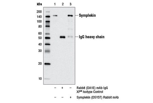 Immunoprecipitation Image 1: Symplekin (D5Y3T) Rabbit mAb