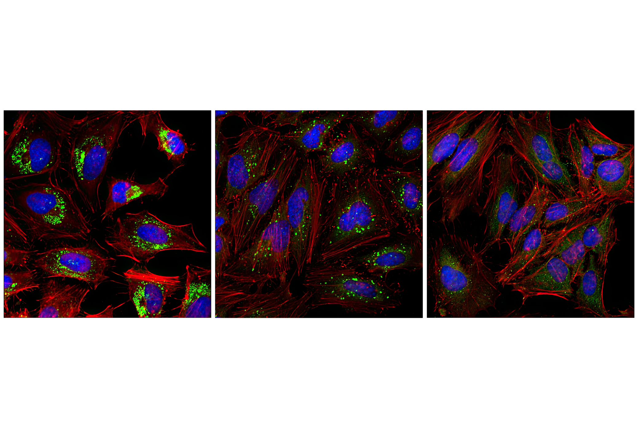 Immunofluorescence Image 1: LC3A/B (D3U4C) XP® Rabbit mAb (Alexa Fluor® 488 Conjugate)