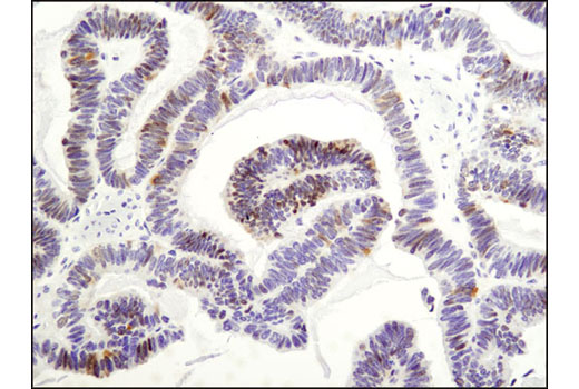 Immunohistochemistry Image 1: Wee1 (D10D2) Rabbit mAb (BSA and Azide Free)