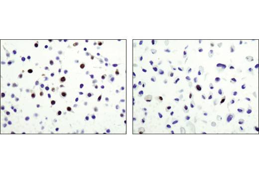 Immunohistochemistry Image 2: Wee1 (D10D2) Rabbit mAb (BSA and Azide Free)