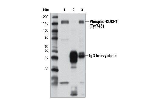 Immunoprecipitation Image 1: Phospho-CDCP1 (Tyr743) Antibody