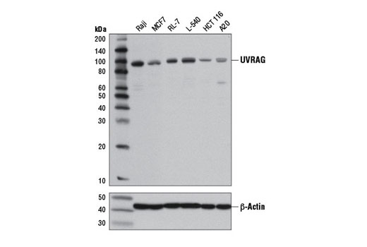  Image 1: Beclin-1 Complex Antibody Sampler Kit