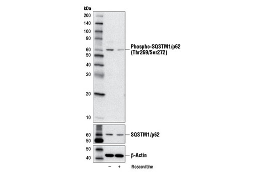 Western Blotting Image 1: Phospho-SQSTM1/p62 (Thr269/Ser272) Antibody