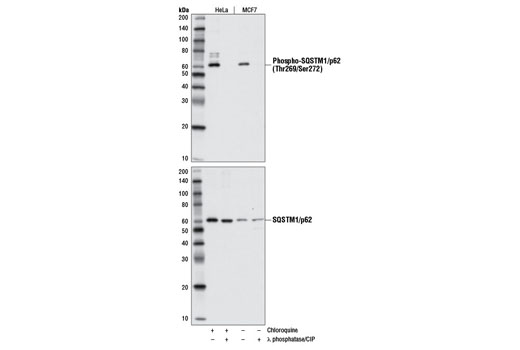 Western Blotting Image 2: Phospho-SQSTM1/p62 (Thr269/Ser272) Antibody