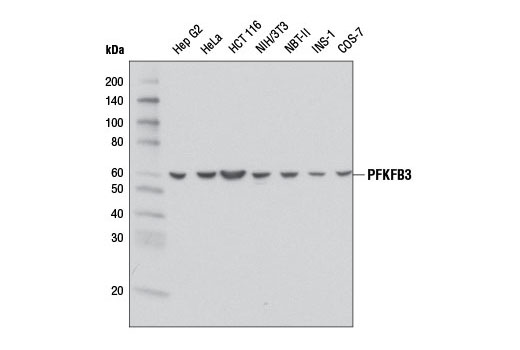  Image 3: Glycolysis II Antibody Sampler Kit