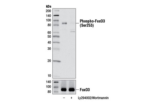 Image 3: Forkhead Signaling Antibody Sampler Kit