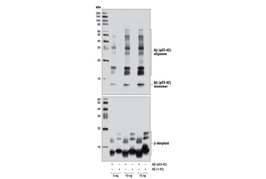 Western Blotting Image 1: β-Amyloid (pE3 Peptide) Antibody