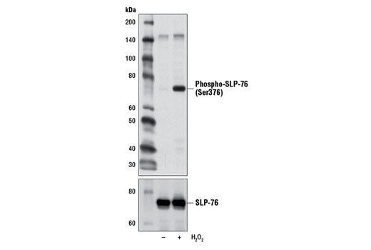 Western Blotting Image 1: Phospho-SLP-76 (Ser376) Antibody
