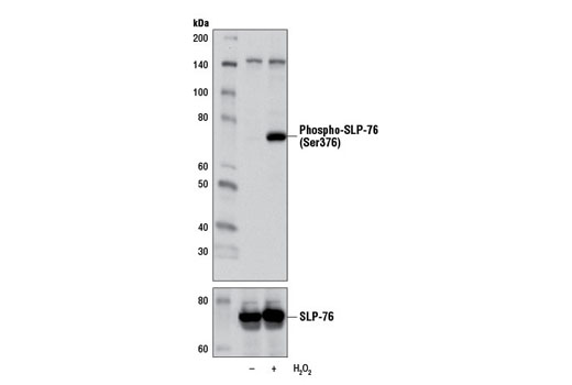 Western Blotting Image 2: Phospho-SLP-76 (Ser376) Antibody