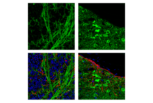  Image 43: Mature Neuron Marker Antibody Sampler Kit