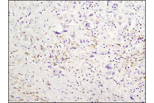  Image 8: PhosphoPlus® Syk (Tyr525/526) Antibody Duet